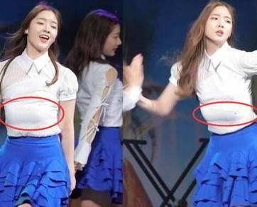 明星表演时出过哪些尴尬事？