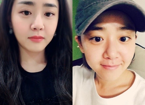 文根英这2、3天内就会动第4次手术 文根英这2、3天内就会动第4次手术