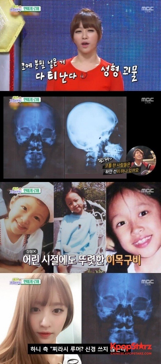 HaNi公开了CT照和儿时照片 HaNi公开了CT照和儿时照片