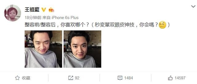 王祖蓝亲口承认已经整容了,真的吗? 王祖蓝亲口承认已经整容了,真的吗?