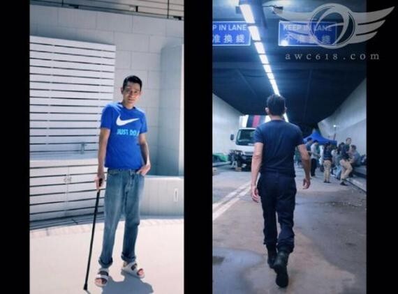 刘德华今天则发布拄着拐杖的照片