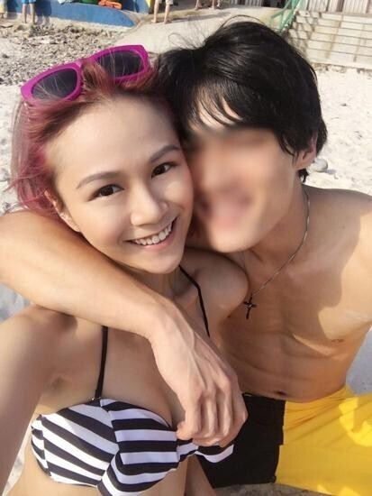 周晓彤日前在Facebook上传一张手脚瘀伤的照片