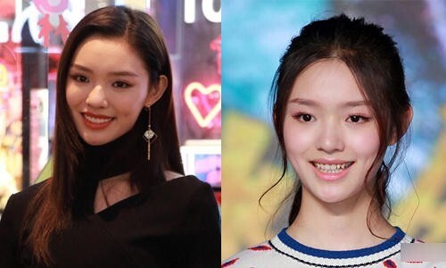 林允这也被整容了?