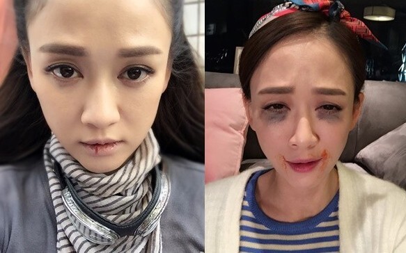 为什么陈乔恩一天要吃75颗药? 为什么陈乔恩一天要吃75颗药?