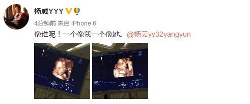 杨威晒杨云腹中胎儿B超照,而且还是龙凤胎? 杨威晒杨云腹中胎儿B超照,而且还是龙凤胎?