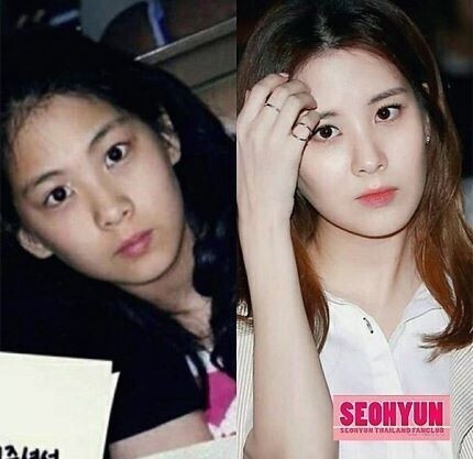 少女时代徐贤上传了一张小时候与现在的对比图 少女时代徐贤上传了一张小时候与现在的对比图