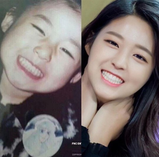 雪炫31日在INS上传了一张小时候和现在模样照 雪炫31日在INS上传了一张小时候和现在模样照